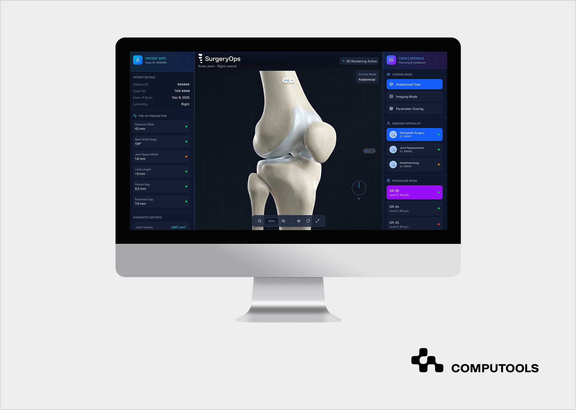 SurgeryOps case study screen